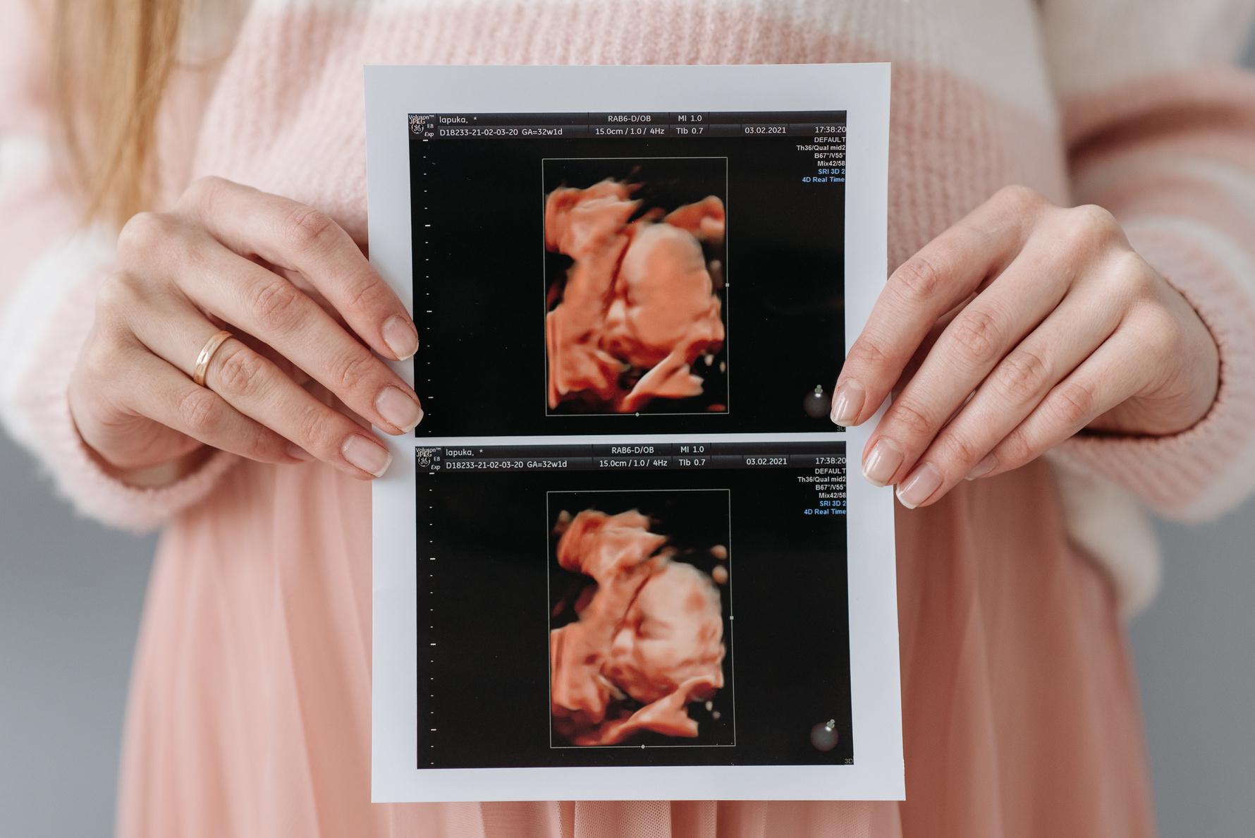 A Pregnant Woman Holding an Ultrasound Picture